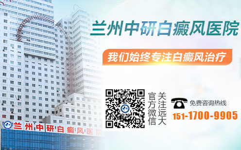 兰州中研白癜风医院